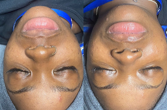 Melanated Glow Skin Body Oil